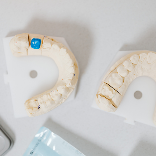 Dental Crowns