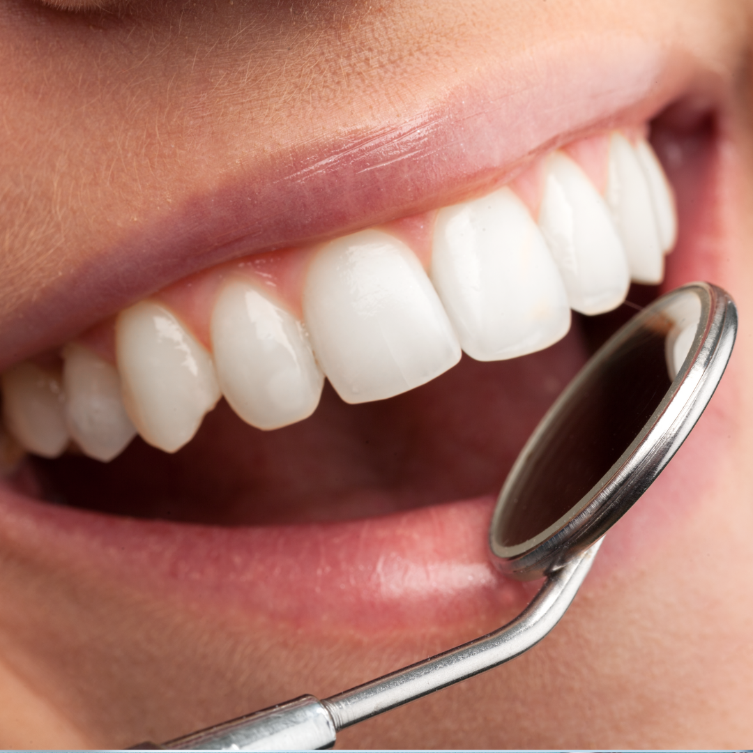 Family Dentistry - Torrance Dental Center