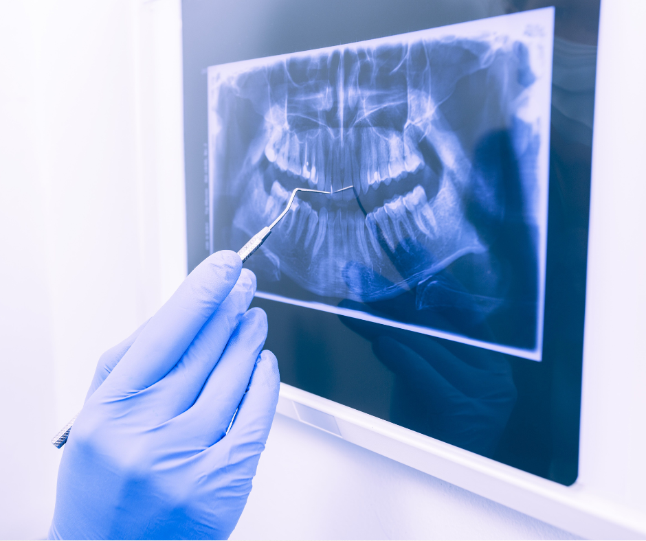 Emergency Dentistry - Torrance Dental Center