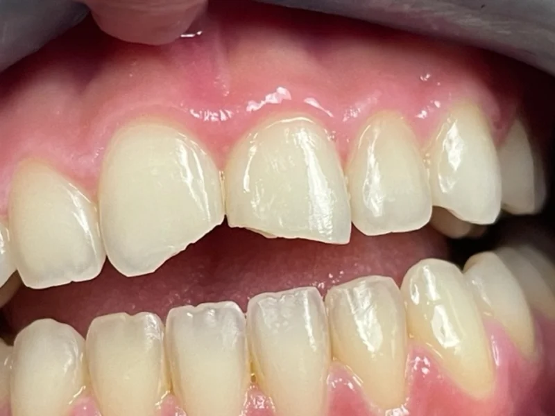 Actual Patient before Cosmetic Dentistry