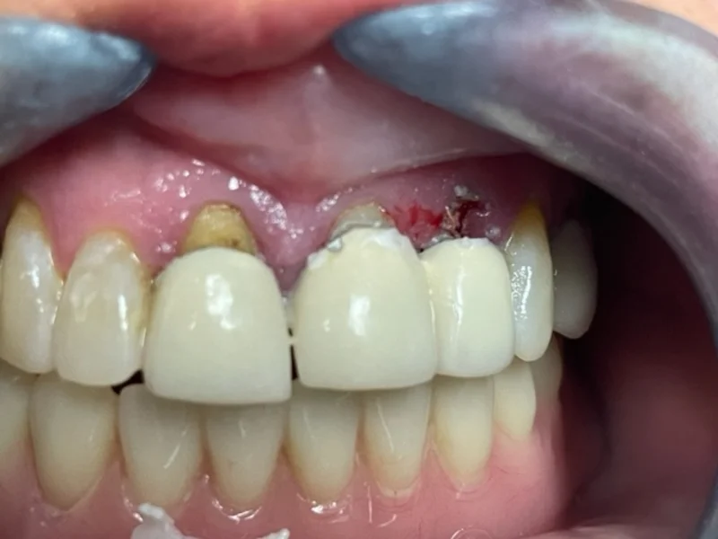 Actual Patient before Cosmetic Dentistry