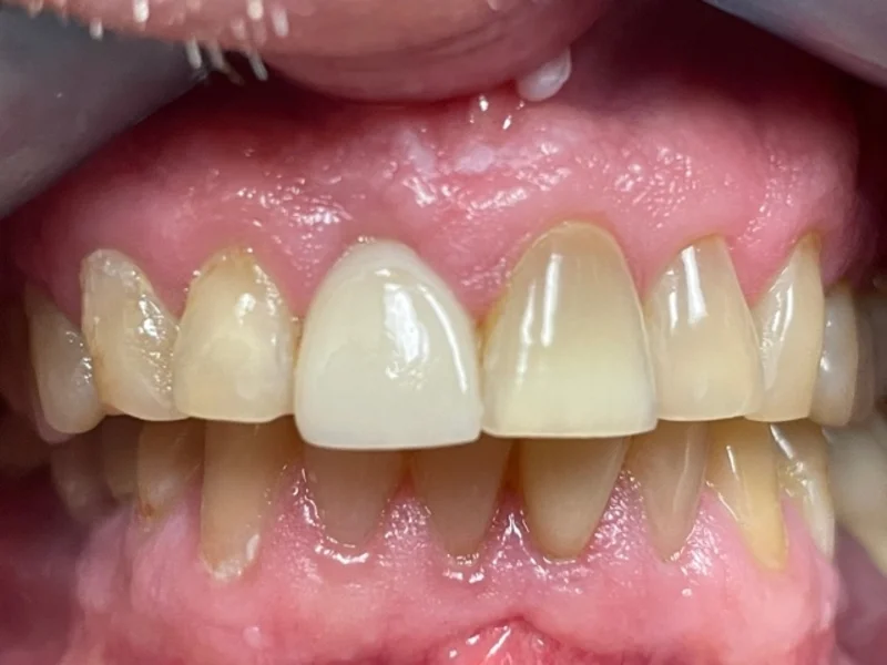 Actual Patient after Cosmetic Dentistry